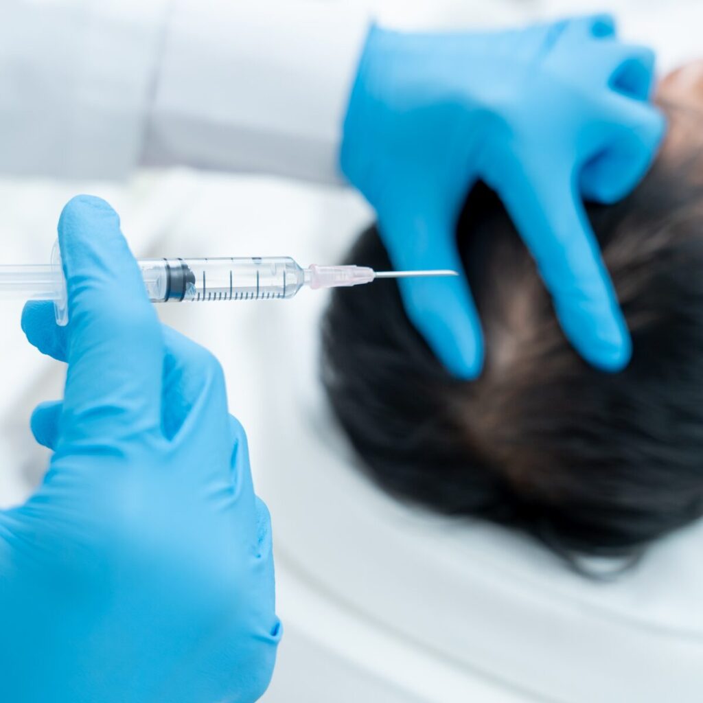 Preparing injection into scalp.