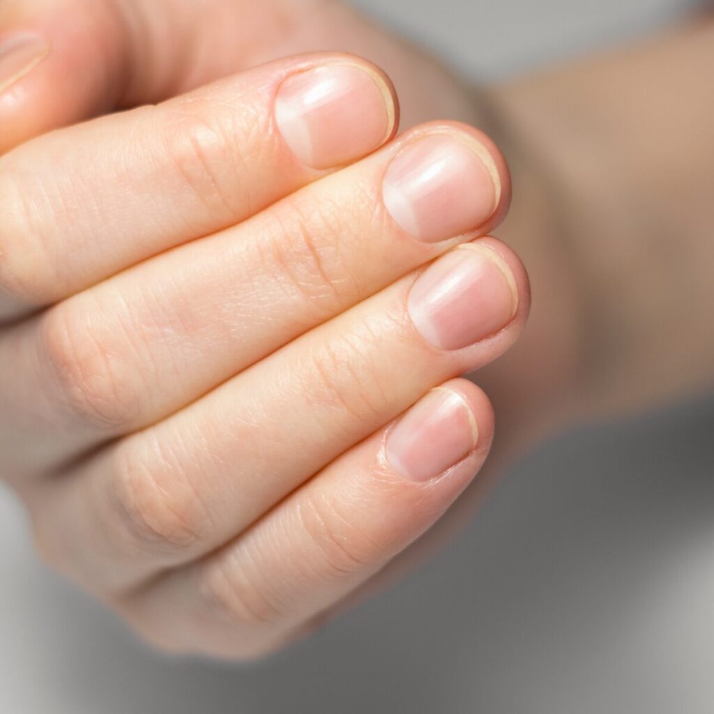 Close up view of healthy nails.