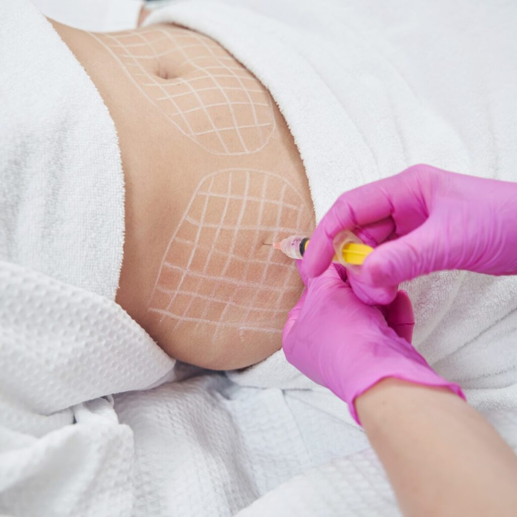 Person's abdomen being injected.